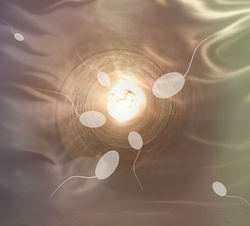 inseminazione intrauterina